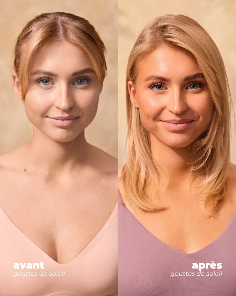 GOUTTES DE SOLEIL AVANT APRES